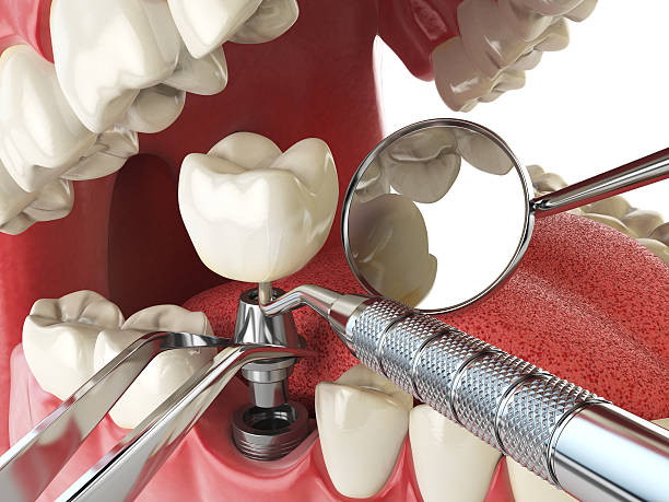 Best Root Canal Emergency Dentist  in Riverdale, NJ